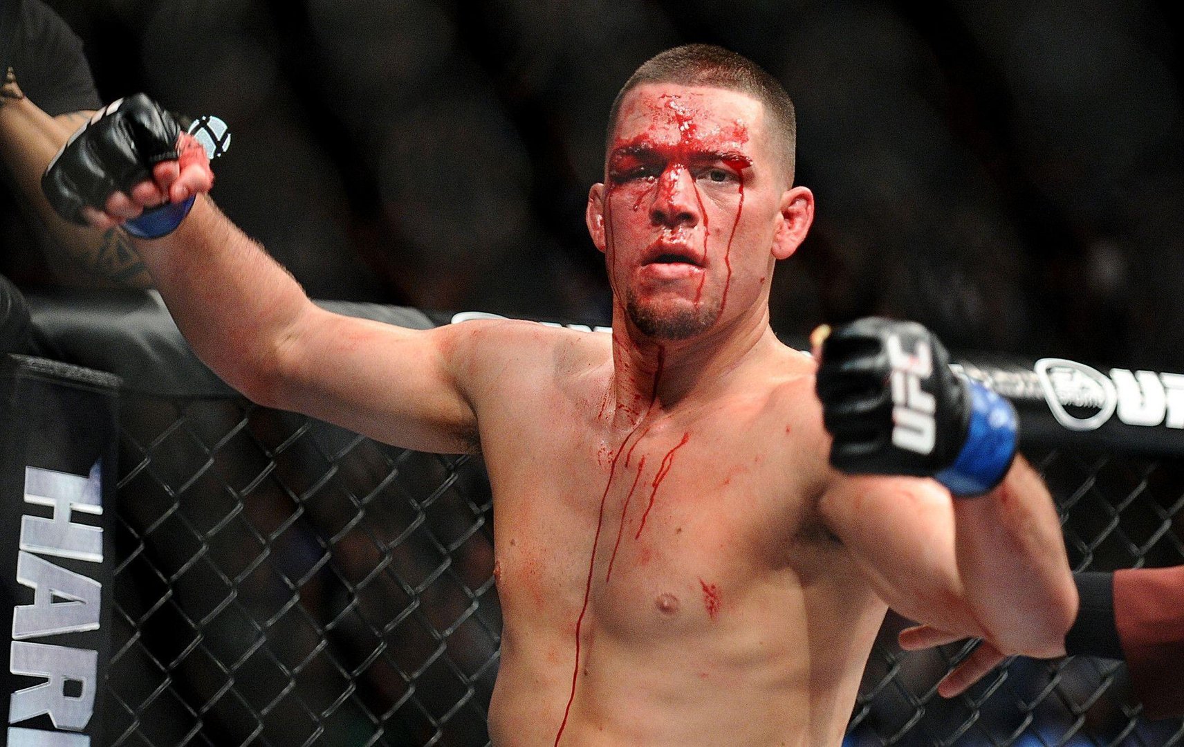 Nate Diaz Bloody Wallpapers.jpg